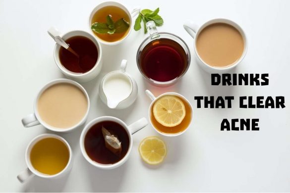 drinks that clear acne