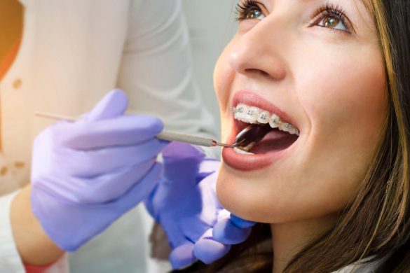 What Is Orthodontics?